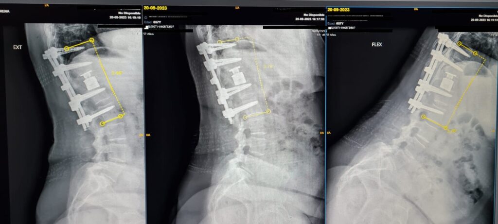 Radiography