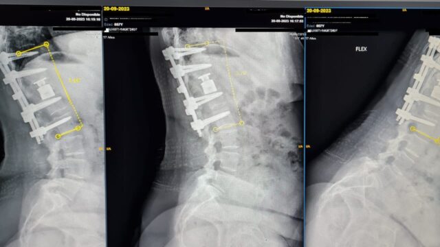 Radiography